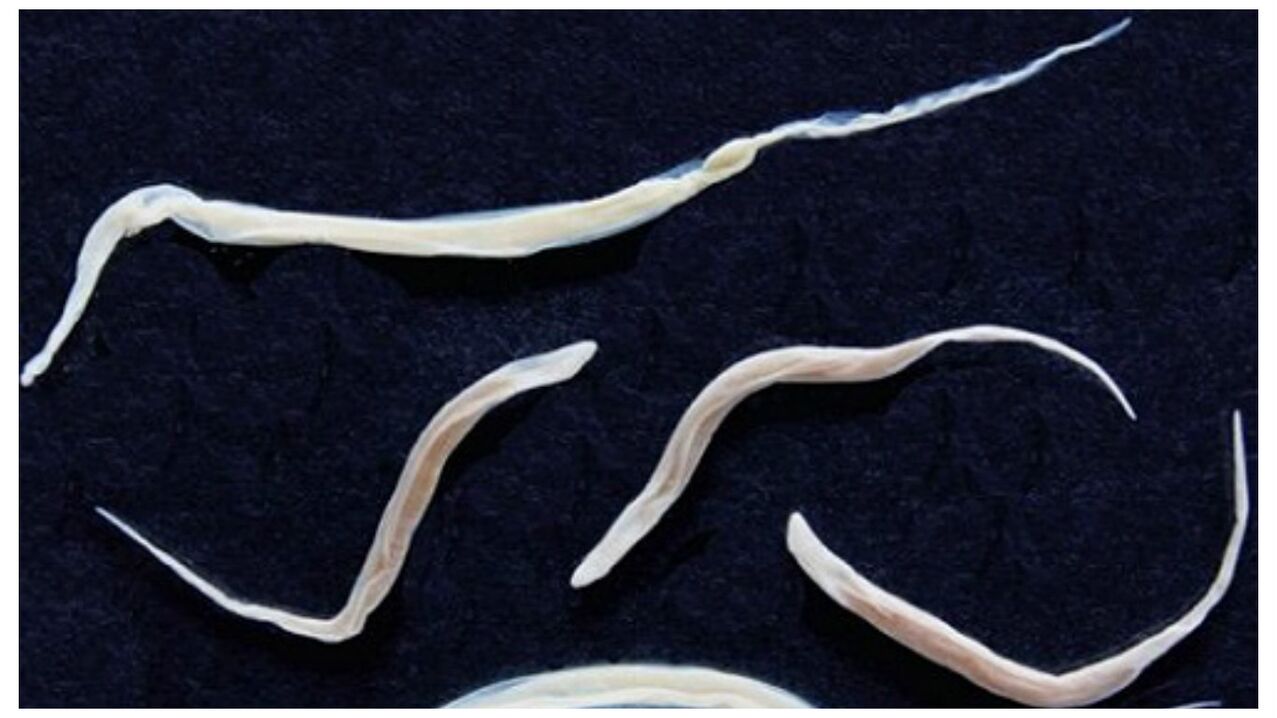 Worms are common parasites belonging to the group of helminths.